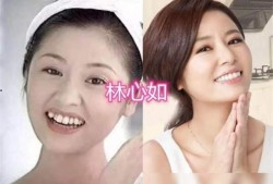 牙医爆料明星整牙视频播放,牙医亲述整牙全过程