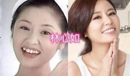 牙医爆料明星整牙视频播放,牙医亲述整牙全过程