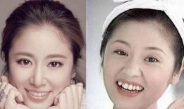 牙医爆料明星整牙视频播放,牙医亲述整牙全过程